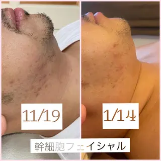 プルケル スパのエステ・リラクイメージ