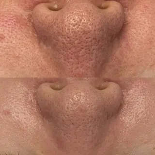 べアール所属・小顔/毛穴/ニキビ salon bealのエステ・リラクイメージ