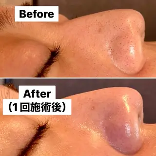 Beauty salon  Liko所属・LIKO フェイシャル&ボディのエステ・リラクイメージ