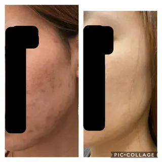 BeautySalonGemmy所属・Gemmy 愛美のエステ・リラクイメージ