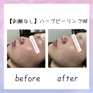 肌質改善Charme coco 増毛のエステ・リラクイメージ