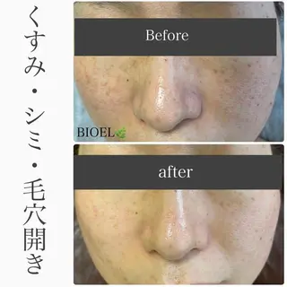 ハーブピーリング専門 BIOPLUS＋川崎のエステ・リラクイメージ