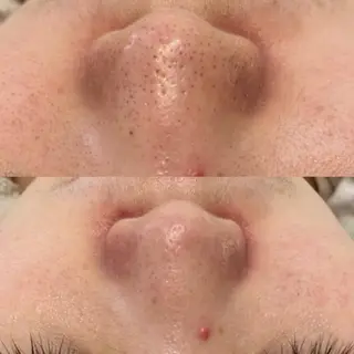 ララ/ハーブ メゾンリュバンのエステ・リラクイメージ