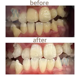 ホワイトニング ショップ船橋店🦷のエステ・リラクイメージ