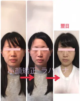 小顔矯正＆ロミロミ ラハイナ所属・小顔矯正 ラハイナのエステ・リラクイメージ