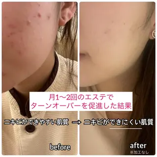 pansy(パンジー)上野フェイシャルエステ専門店所属・pansy saraのエステ・リラクイメージ