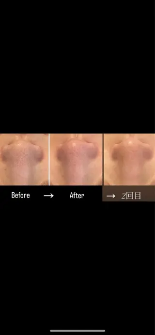 半田市エステサロン　シェソワ所属・肌荒れ/疲れケア シェソワのエステ・リラクイメージ