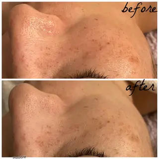 メンズ メナード岐阜市茜部 杉浦のエステ・リラクイメージ