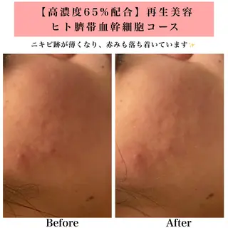 Bellesthe （ベルエステ）のエステ・リラクイメージ