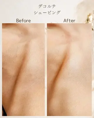 シェービングサロン アンダブル/鴨井のエステ・リラクイメージ