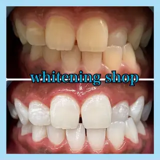 ホワイトニング ショップ千葉店のその他イメージ