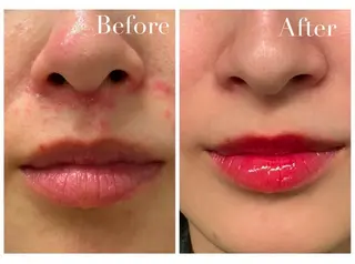 Avenir Brillant所属・松田 紗季のエステ・リラクイメージ