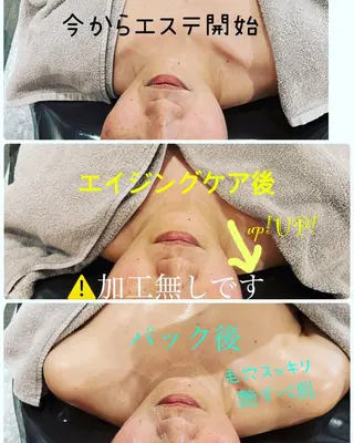 【安心ハンドテク】 メナード富田丘のエステ・リラクイメージ