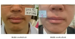 Salon pupa 店長のエステ・リラクイメージ