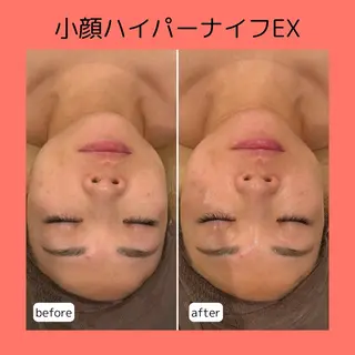 赤澤/本気痩せ・脱毛 ・ノーファンデ肌のその他イメージ