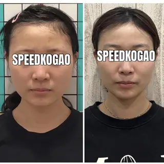 小顔矯正Speed KOGAO渋谷本店のエステ・リラクイメージ