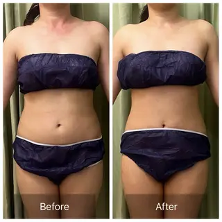 美腸×筋膜🌿 ウェルネスラボ星ヶ丘のエステ・リラクイメージ