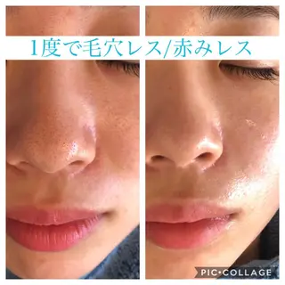 セミロング カラー パーマ ヘアアレンジ キッズ ネイル マツエク・マツパ Ensor Clair所属・EnsorClair 代表　野口真央のエステ・リラクイメージ