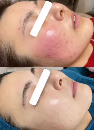 パーソナル肌質改善 🦋APRI🅿️有のエステ・リラクイメージ