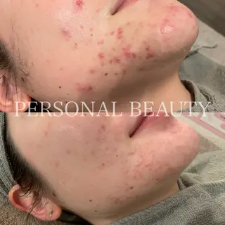 PERSONAL BEAUTY🪻のエステ・リラクイメージ