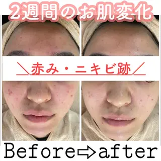 セミロング カラー パーマ ヘアアレンジ メンズ キッズ ネイル マツエク・マツパ ニキビ&跡改善サロン オーナー光木のエステ・リラクイメージ