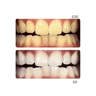 歯のセルフホワイトニング専門店GLOW(グロウ)所属・東区香椎歯のセルフホ ワイトニングGLOWのその他イメージ