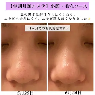 Bellesthe （ベルエステ）のエステ・リラクイメージ