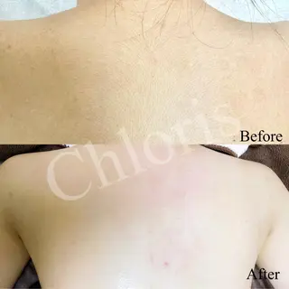 川越ローマピンク 光脱毛＆ワックス脱毛のエステ・リラクイメージ