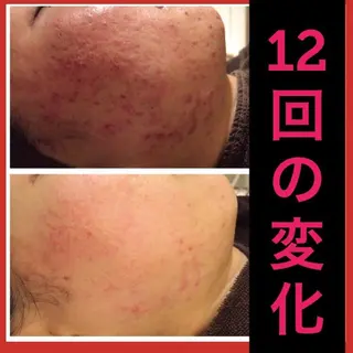 ショート カラー パーマ ヘアアレンジ メンズ キッズ ネイル マツエク・マツパ ニキビ・肌質改善専門 ♡人生が変わるサロンのエステ・リラクイメージ