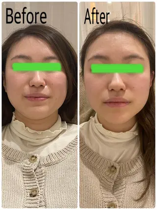 岩切 結子のマツエク・マツパデザイン