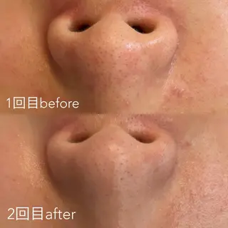 エステティックサロン Liente(リアンテ)所属・Hashimoto .のエステ・リラクイメージ