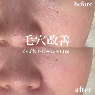 韓国肌管理&小顔 ＩＲＯＨＡのエステ・リラクイメージ