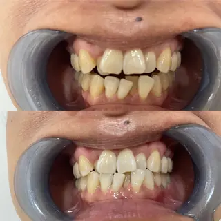 西宮ホワイトニング Kirarie所属・志水 有美のエステ・リラクイメージ