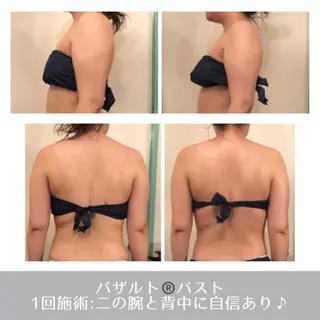 ラ・ルミエール所属・鈴木 えつこのエステ・リラクイメージ