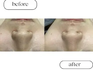 美肌専門サロン RUBONのエステ・リラクイメージ