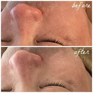 メンズ メナード岐阜茜部 杉浦のエステ・リラクイメージ