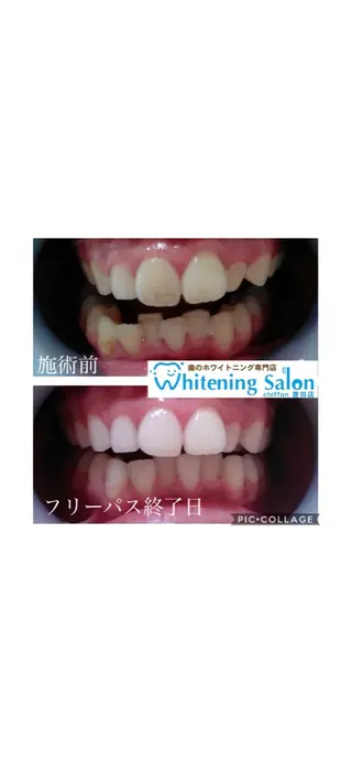 ホワイトニングサロンシフォン豊田店所属・ホワイトニングサロン シフォン豊田店のその他イメージ