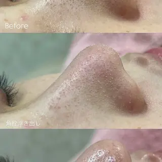 フェイシャル/脱毛 ジョアアンジェ小夷のエステ・リラクイメージ