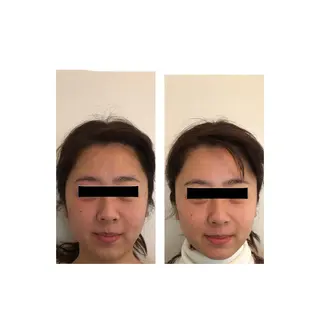 おうちサロン B-ROOMのエステ・リラクイメージ