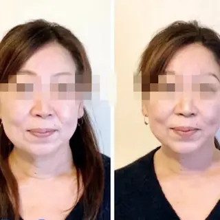 矢向駅前 接骨院のエステ・リラクイメージ