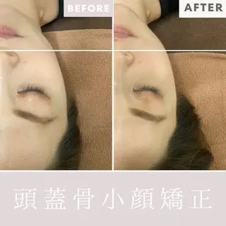 Purua beuty所属・月1肌管理 RINAのエステ・リラクイメージ