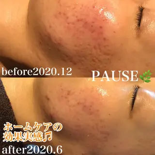 浜野 恵美のエステ・リラクイメージ