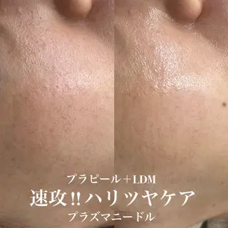 韓国肌管理&小顔 ＩＲＯＨＡのエステ・リラクイメージ