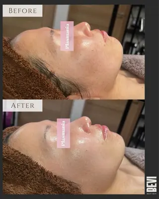 Bevi salonのその他イメージ