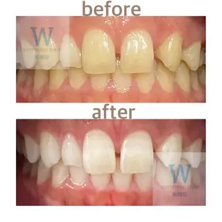 ホワイトニング ショップ船橋２号店のエステ・リラクイメージ