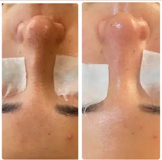 Lien ~beauty salon~所属・福島⌇毛穴専門サロン ⌇﻿モニター募集のエステ・リラクイメージ