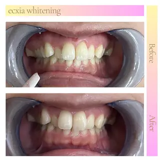 セルフホワイトニングサロン　エクシアホワイト西尾店所属・エクシアホワイト西尾 堀内恵のその他イメージ