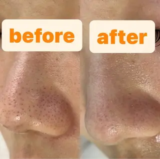 都度払い肌改善専門店 店長二上文香のエステ・リラクイメージ