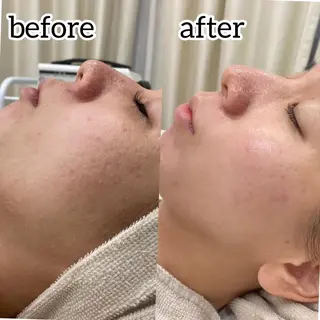 laluna saki...のその他イメージ