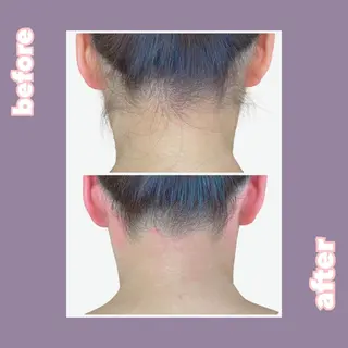 【痩身・脱毛サロン】 REBISKIN🌱のエステ・リラクイメージ